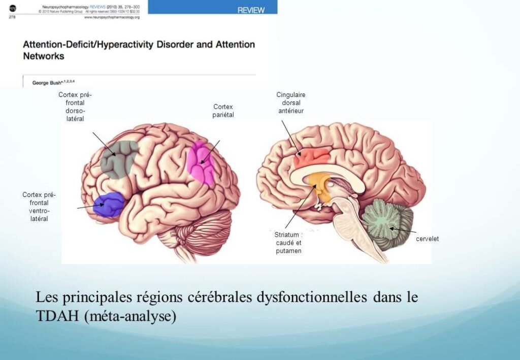 FONCTIONNEMENT DU CERVEAU TDAH
