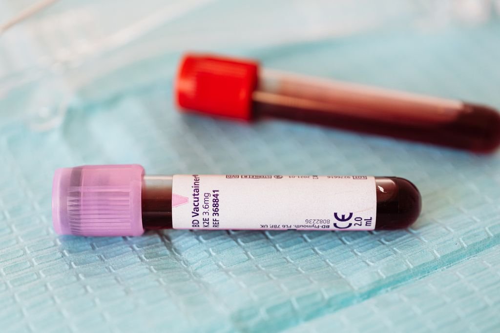 dosage ferritine et fer dans le tdah cerveau neuroatypique